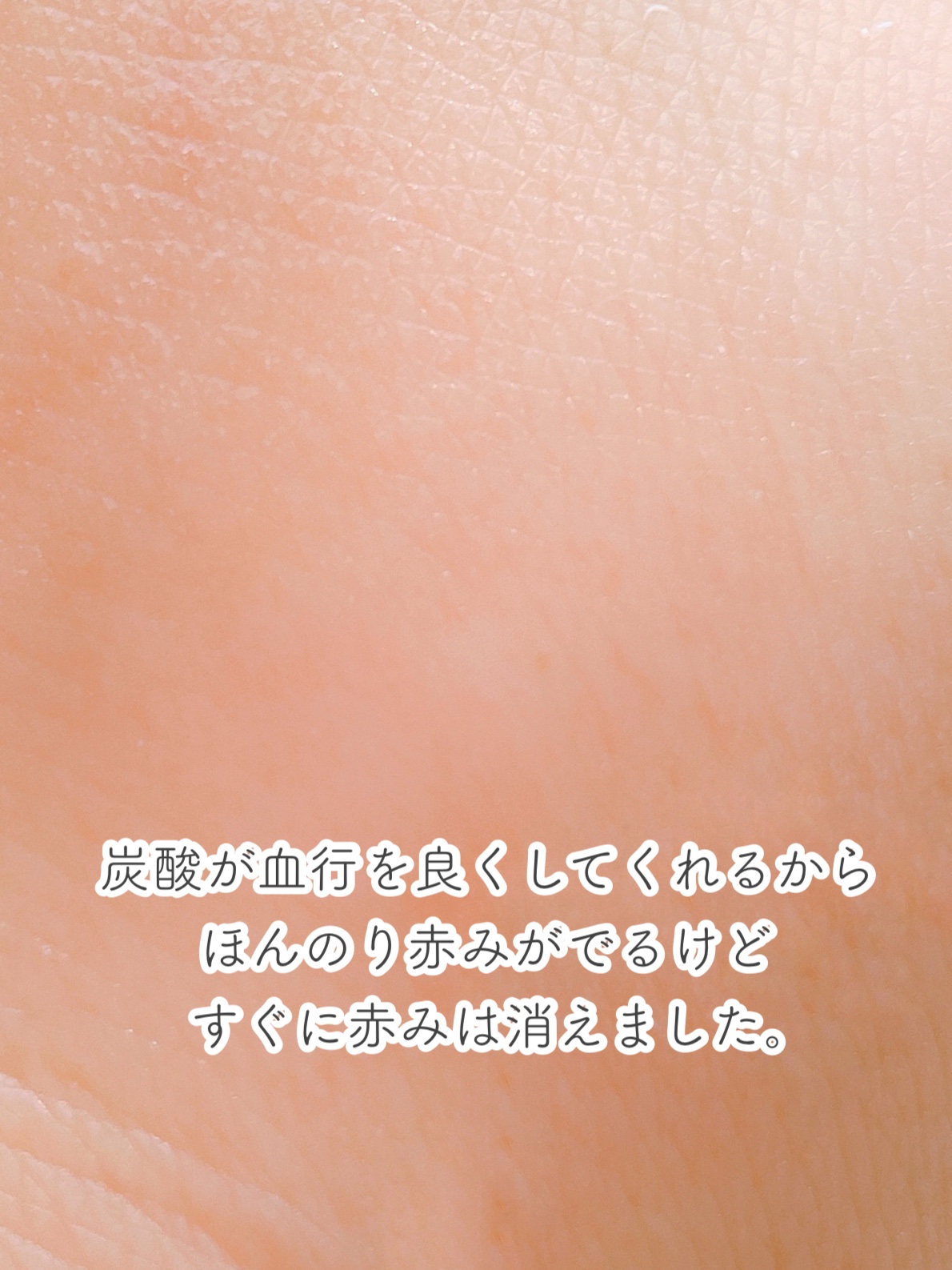 レモンパフソーダ/株式会社ムース/化粧水を使ったクチコミ（3枚目）