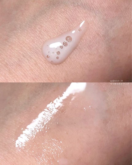 カクタスバンド/イエスパ/ツボ押し・マッサージグッズを使ったクチコミ(6枚目)