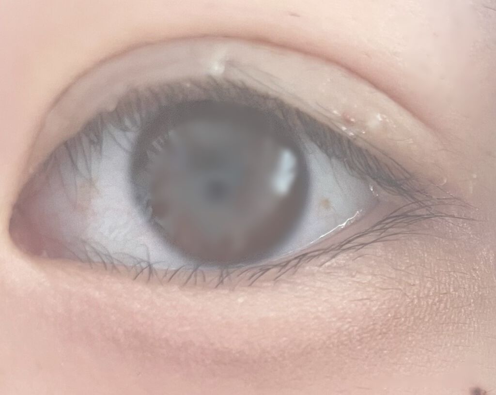 オリシキ アイリッドスキンフィルム		/D-UP/二重まぶた用アイテムを使ったクチコミ（2枚目）