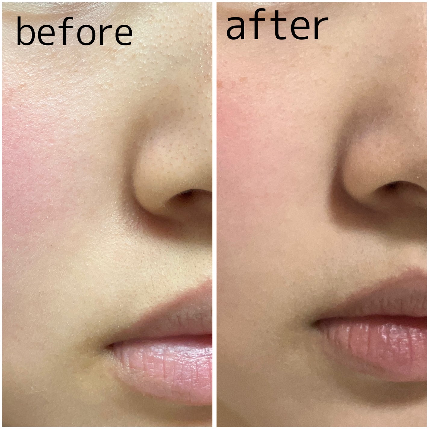 ブライトピュアパック/CandyDoll/洗い流すパック・マスクを使ったクチコミ(4枚目)