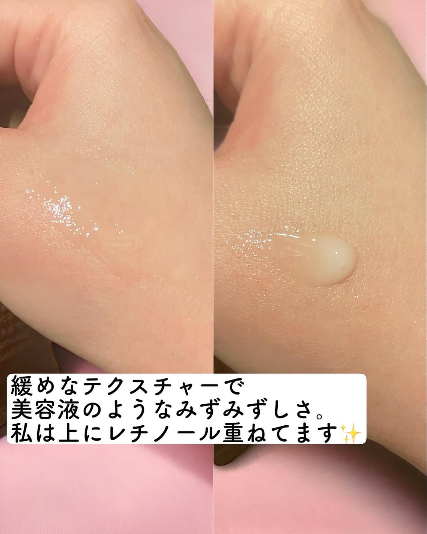 Plenum リンクルダイレクト エッセンス/N organic/美容液を使ったクチコミ(3枚目)