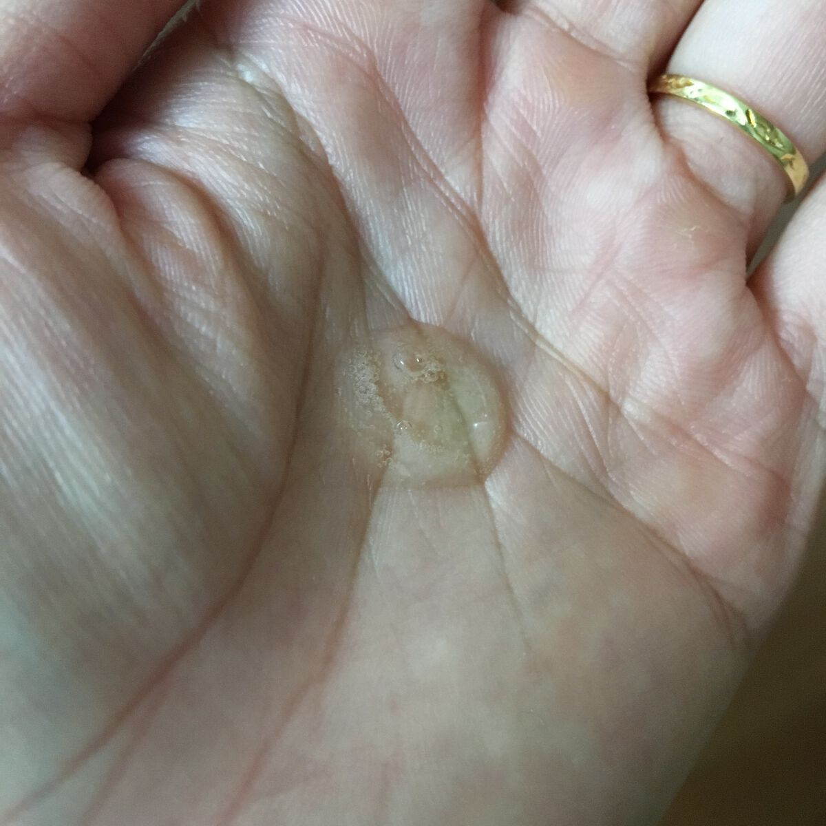 ビタペアC 集中美容液スペシャルセット/ネイチャーリパブリック/美容液を使ったクチコミ（3枚目）