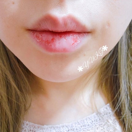 モイスチャーリップ UV/ニベア/リップクリームを使ったクチコミ(6枚目)