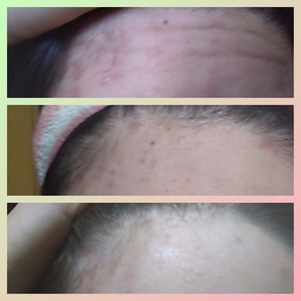 エスセレクト サプリメント　ビタミンC/S SELECT/健康サプリメントを使ったクチコミ（2枚目）