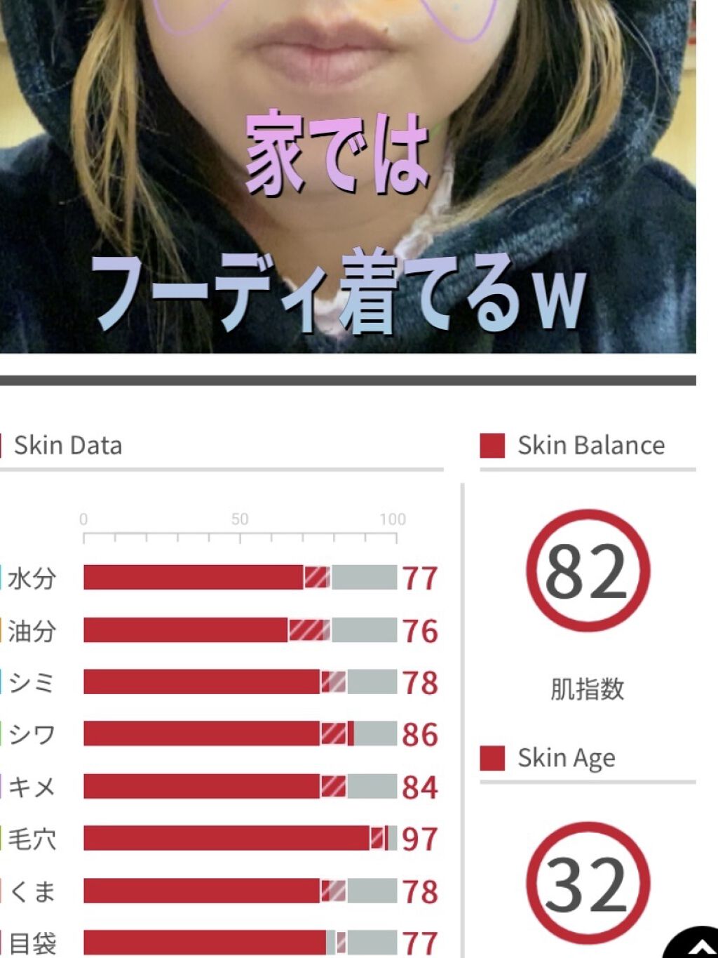 アクアコラーゲンゲル エンリッチリフト EX/ドクターシーラボⓇ/フェイスクリームを使ったクチコミ（1枚目）