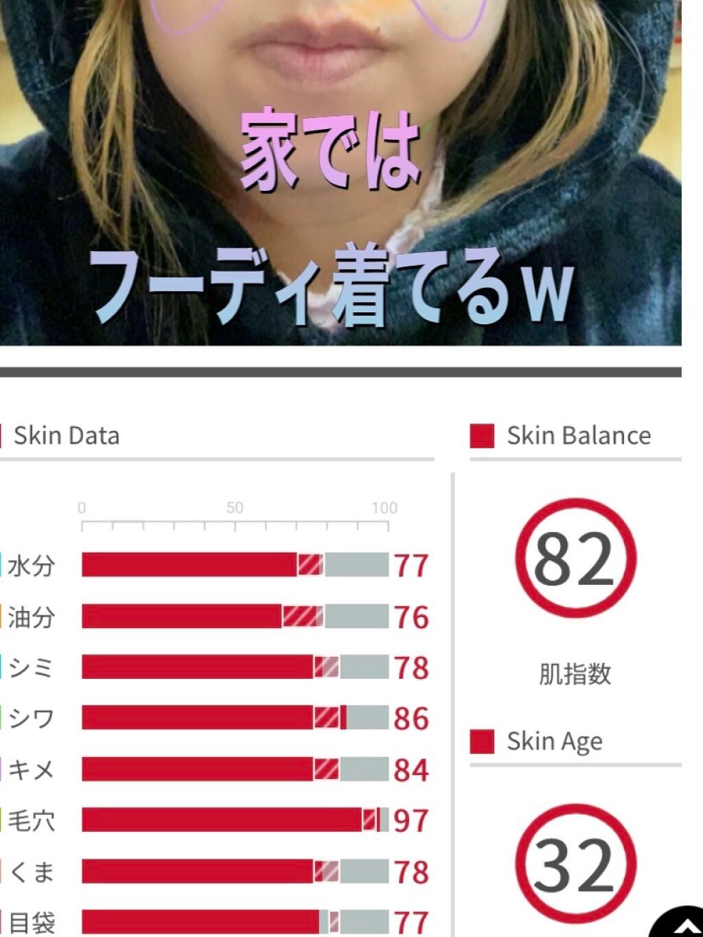 アクアコラーゲンゲル エンリッチリフト EX/ドクターシーラボⓇ/フェイスクリームを使ったクチコミ(1枚目)