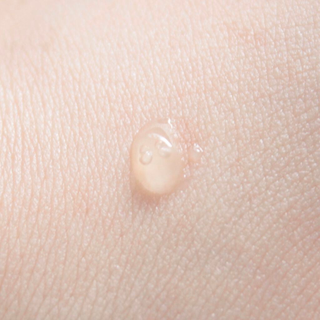 FDR アクネケア エッセンス/ファンケル/美容液を使ったクチコミ(5枚目)