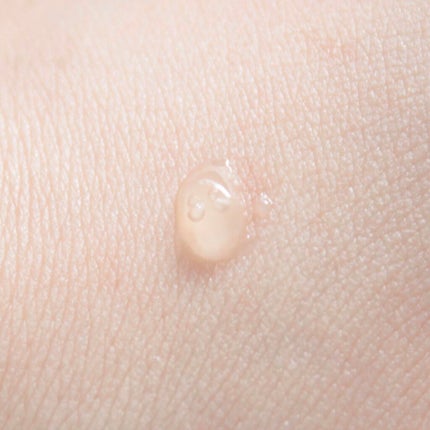 FDR アクネケア エッセンス/ファンケル/美容液を使ったクチコミ(5枚目)