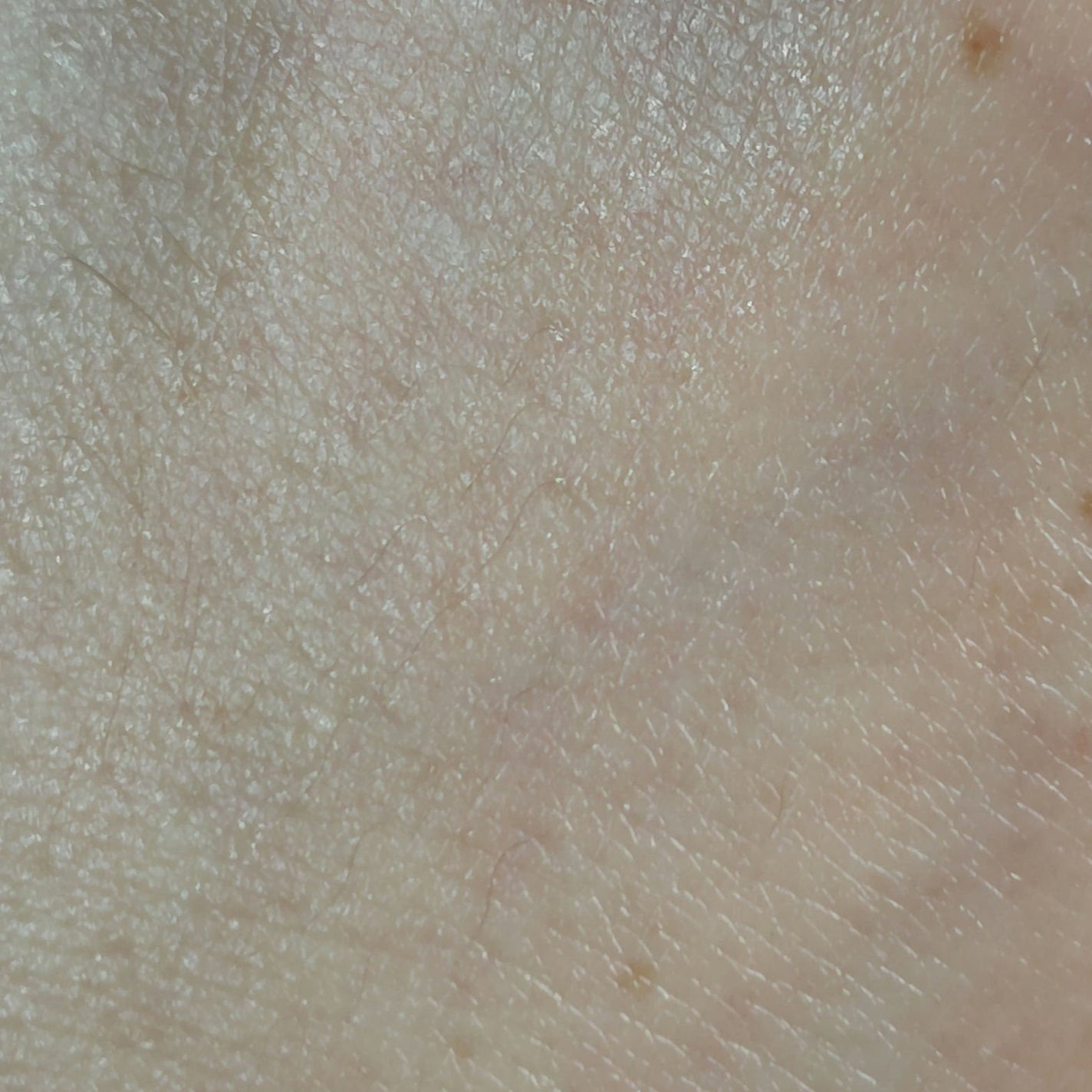 セタフィル モイスチャライジングローション/セタフィル/ボディローションを使ったクチコミ(4枚目)