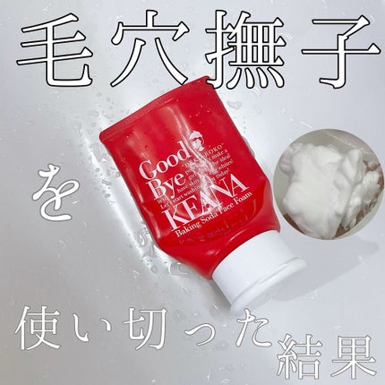 重曹泡洗顔/毛穴撫子/泡洗顔を使ったクチコミ(1枚目)