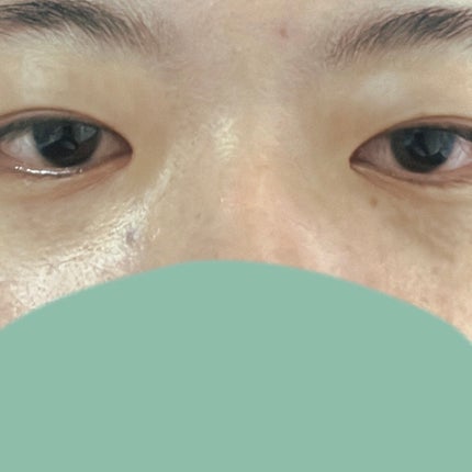 アイレノール クマクリーム/IRENOL/アイケア・アイクリームを使ったクチコミ(4枚目)