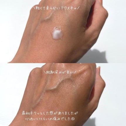 メディリフト ニードルリフトクリーム/YA-MAN TOKYO JAPAN/フェイスクリームを使ったクチコミ(4枚目)