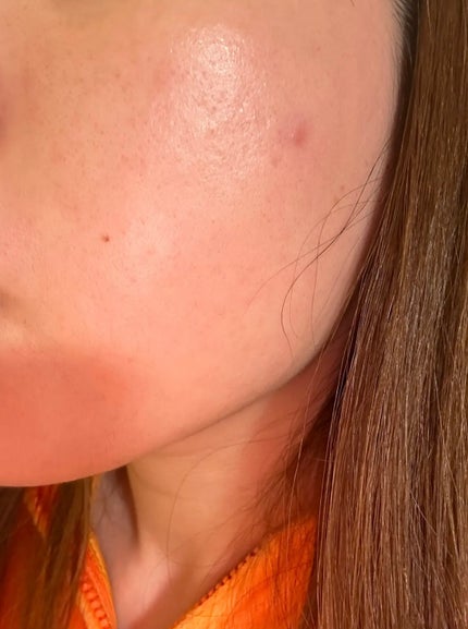 レッドセラム/MEDICUBE/美容液を使ったクチコミ(3枚目)