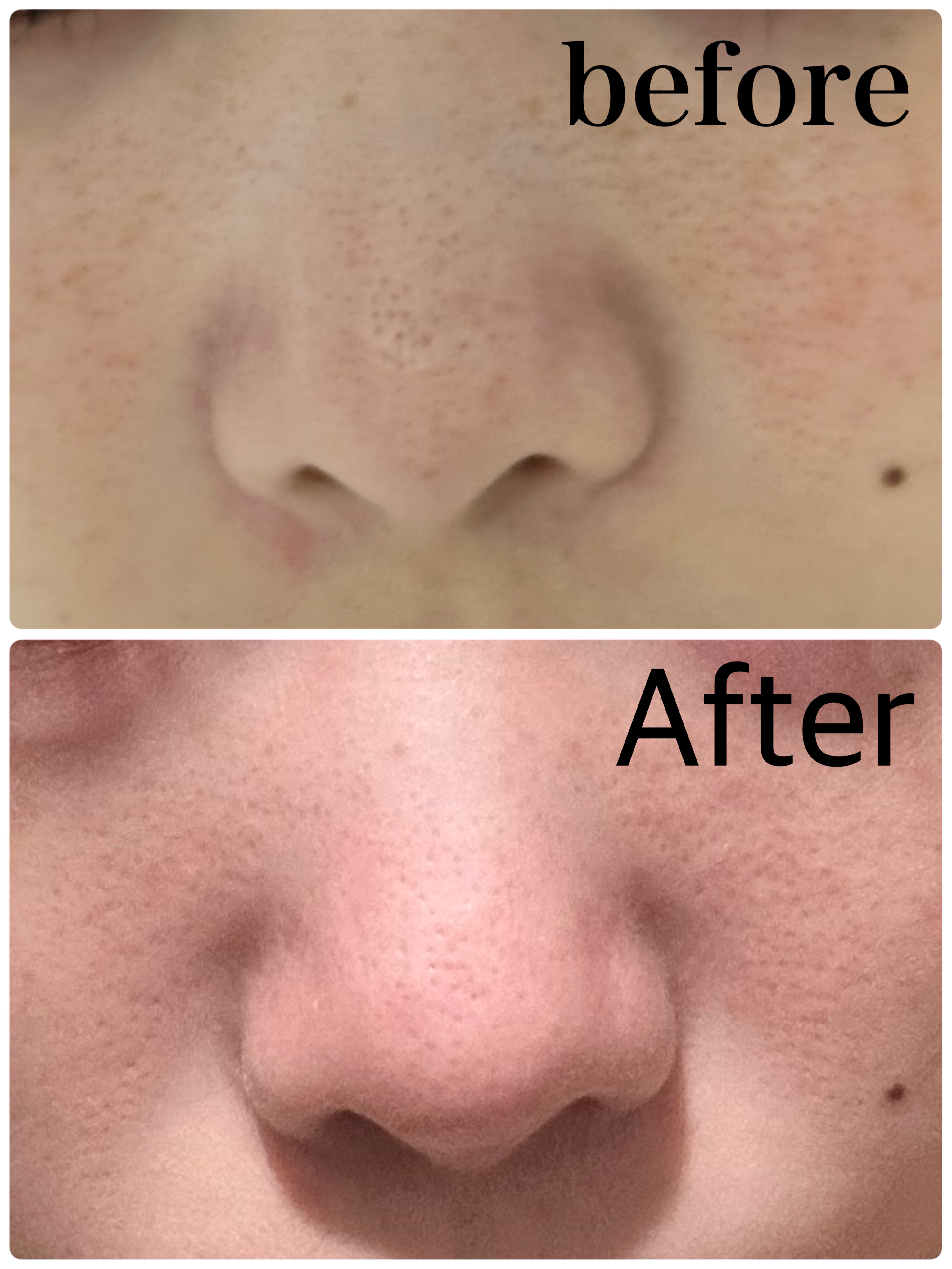 ソフティモ ホワイト クレンジングオイル 本体 240ml/ソフティモ/オイルクレンジングを使ったクチコミ（2枚目）