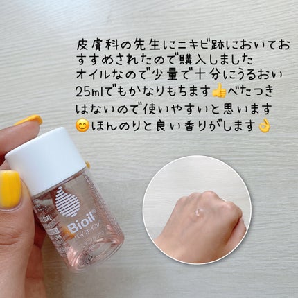 バイオイル/バイオイル/フェイスオイルを使ったクチコミ(3枚目)