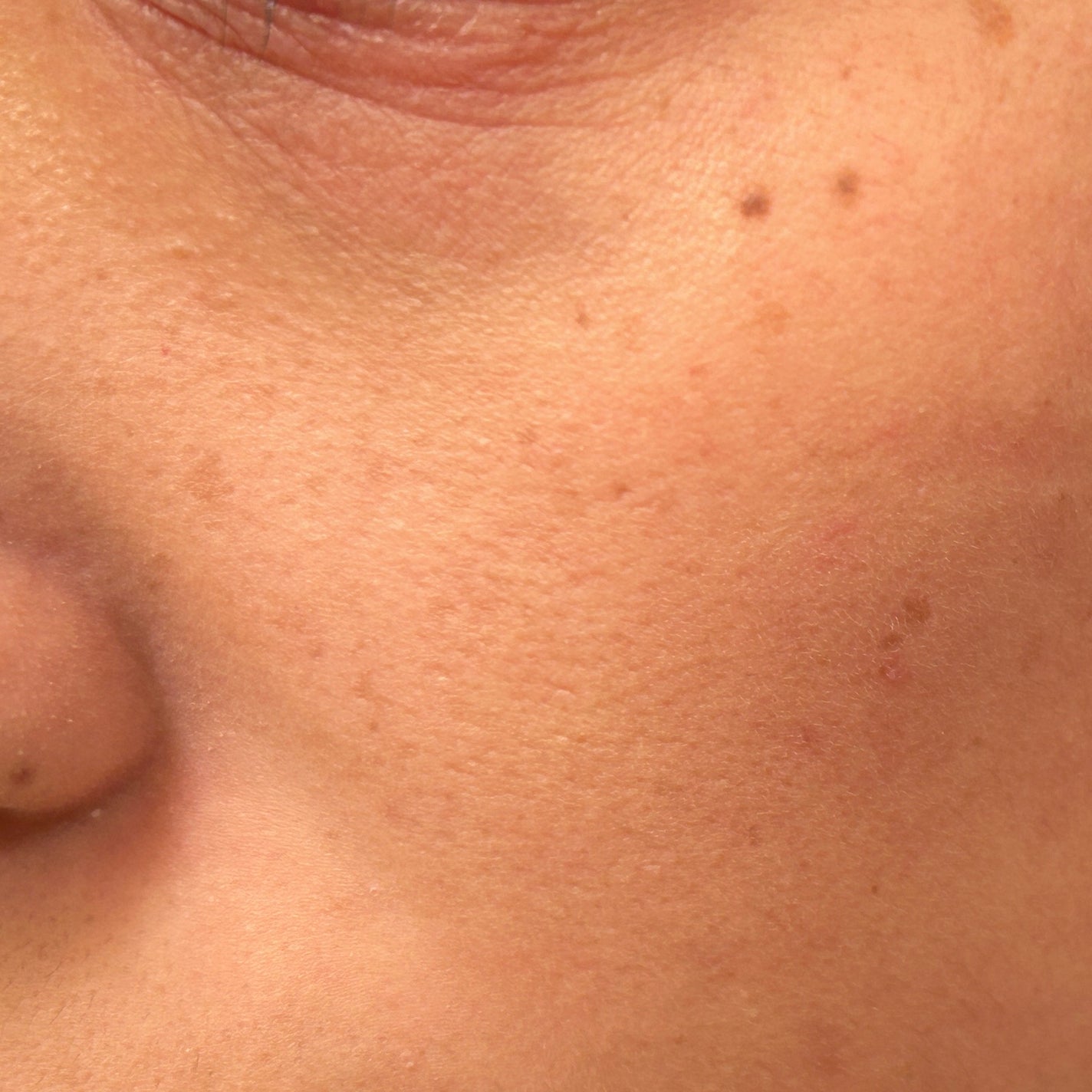 すっぴんパウダー/クラブ/プレストパウダーを使ったクチコミ(7枚目)