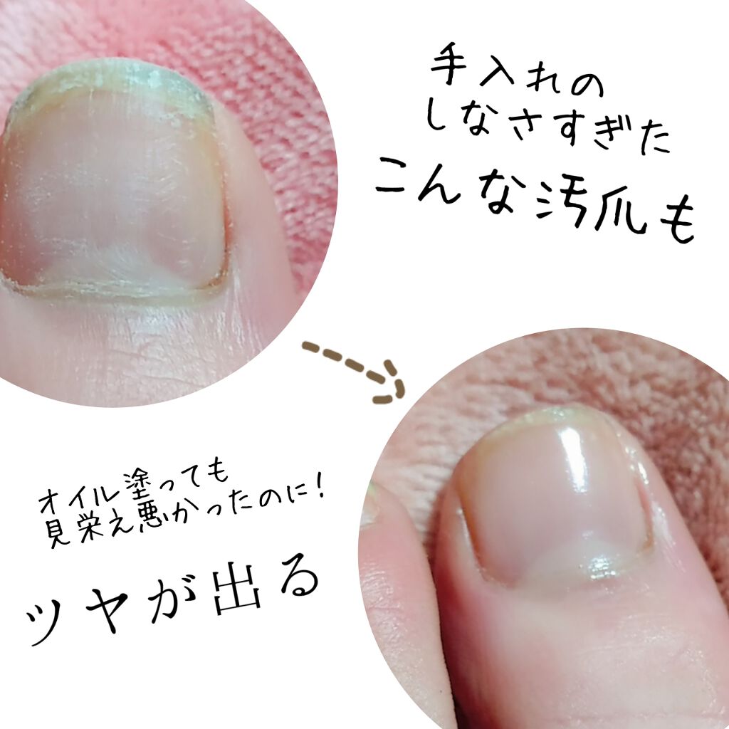 ネイルファンデーション/パラドゥ/マニキュアを使ったクチコミ（1枚目）