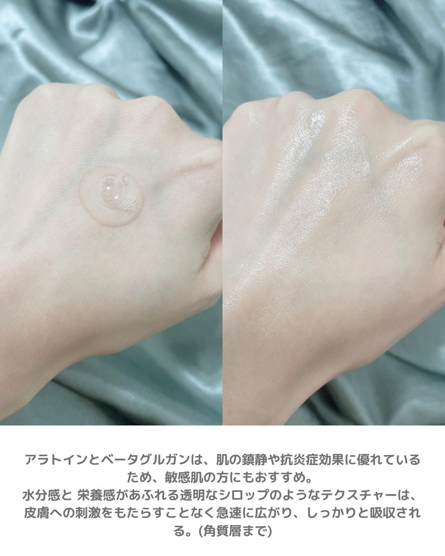 レッドネスリリーバー エッセンス/onoma/美容液を使ったクチコミ(5枚目)