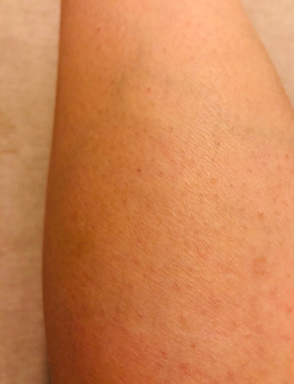 パイナップル豆乳ローションプレミアム/鈴木ハーブ研究所/ボディローションを使ったクチコミ(4枚目)