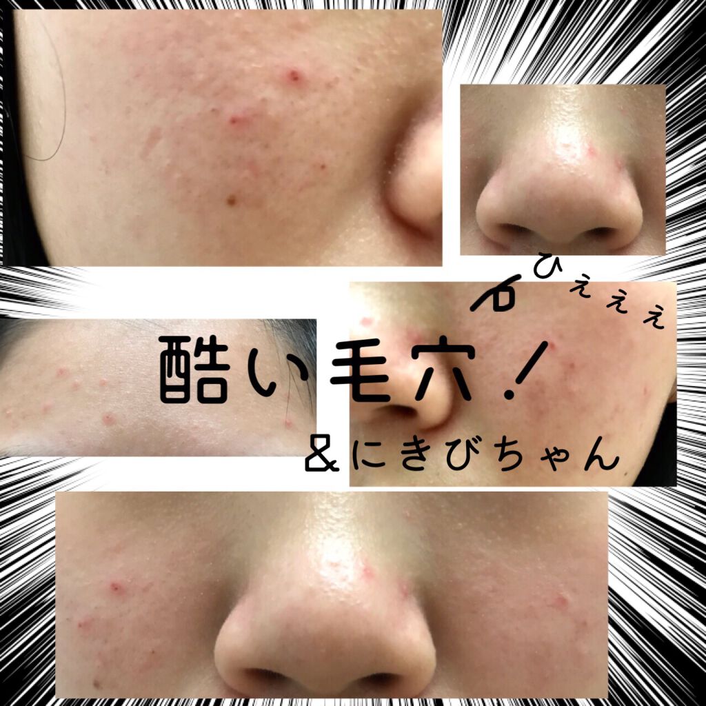 funny on LIPS 「ぽっちゃり肌荒れ女子のデイリー日記気ままに商品のレビューなどし..」(2枚目)