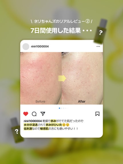 ネイチャーリパブリック公式アカウント on LIPS 「What'snext...?もうすぐ発売予定💛🍃発売前にネリち..」(4枚目)