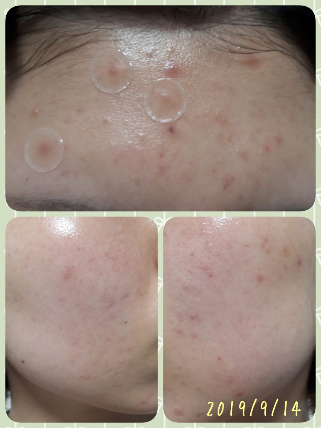 クナイプビオ オイル/クナイプ/ボディオイルを使ったクチコミ(2枚目)