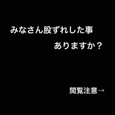  いきなりですが皆さんは股ずれした事ありますか？

 私は最近初めて股ずれしました、、、

 友達とショッピングをしている時に太ももにむず痒さを感じたのですが、気にせず遊んでいて、家に帰って太ももを見て