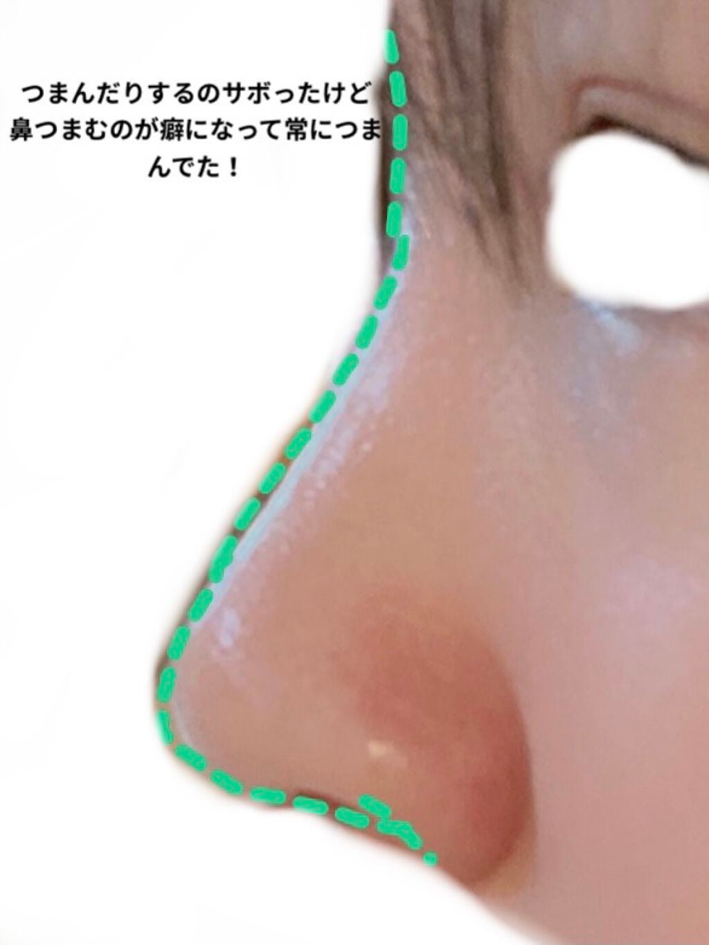 ノーズトレーナー/DAISO/その他スキンケアグッズを使ったクチコミ(4枚目)