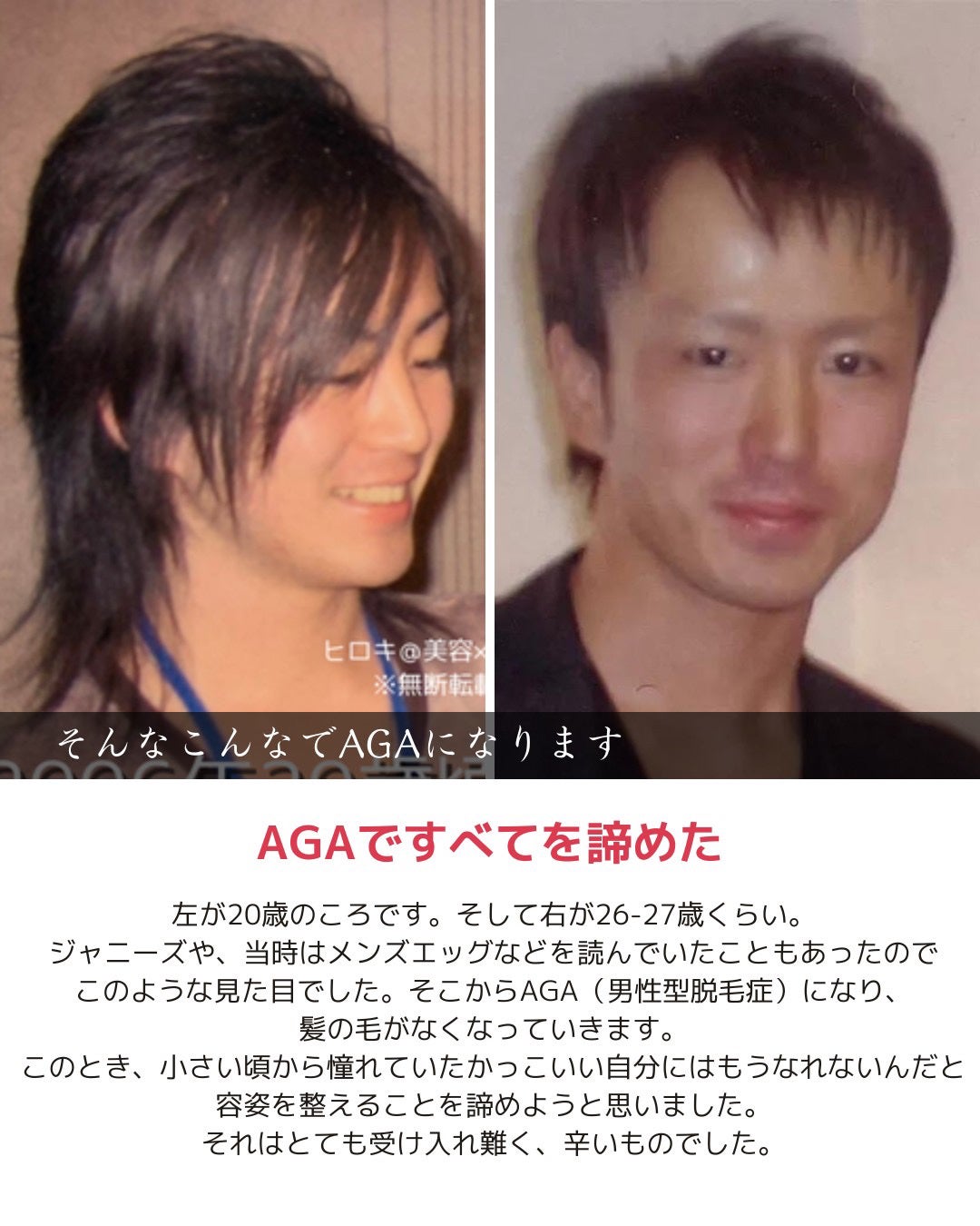 ヒロキ|40歳の美容家 ヘアケア スキンケア on LIPS 「自分が嫌いな人へ。___________どうして自分磨き頑張る..」(5枚目)