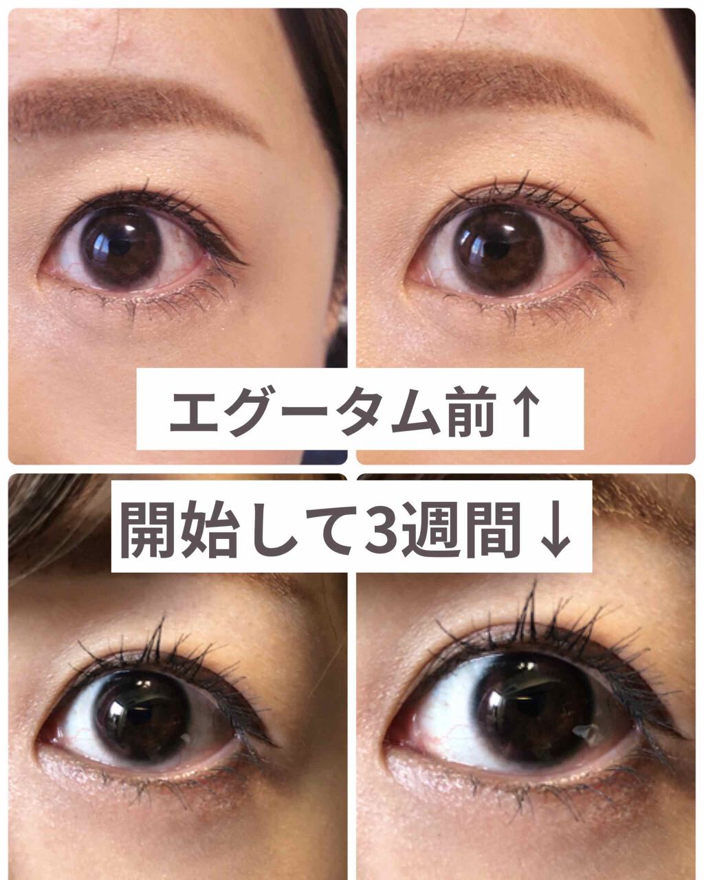 超目玉】【超目玉】エグータム２個セット 基礎化粧品 | purcellcom.com