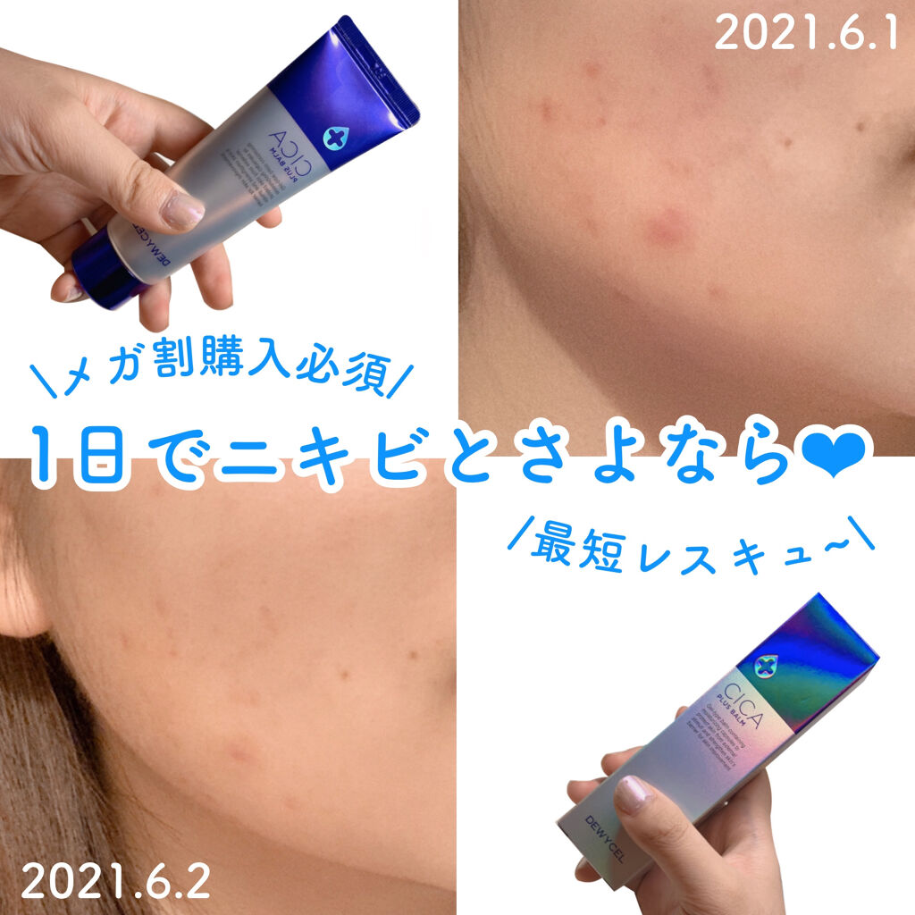 デュイセル シカプラスバーム/DEWYCEL/フェイスクリームを使ったクチコミ（1枚目）