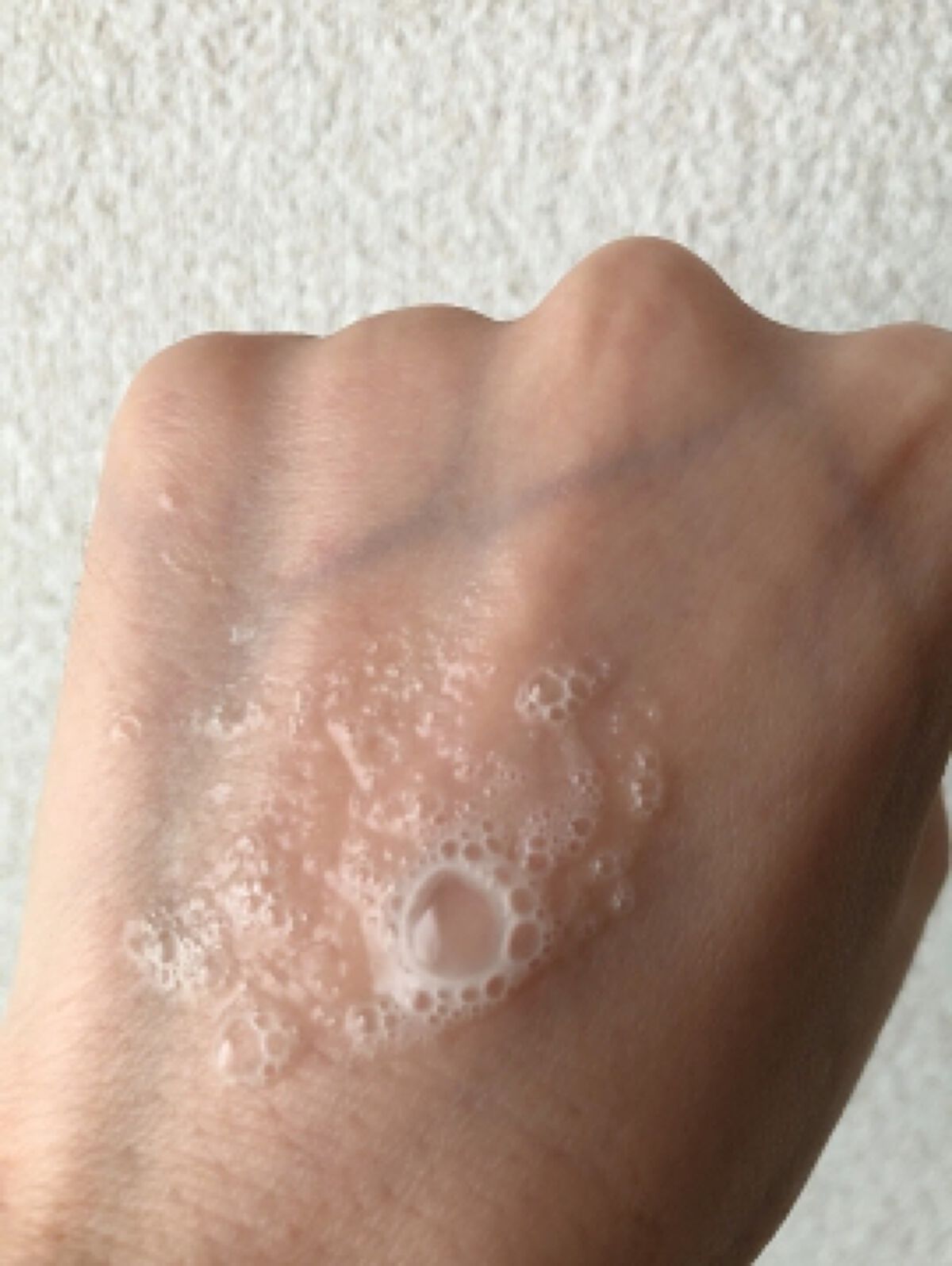 薬用スパークリング スカルプケア/ドクターベルツ/頭皮ローションを使ったクチコミ(3枚目)