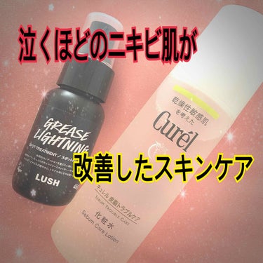 キュレル 皮脂トラブルケア 化粧水のクチコミ「高校生の頃から悩み続けてきた、ニキビ肌です。

クッションファンデに変えたのと、マスクをし始め.....」（1枚目）