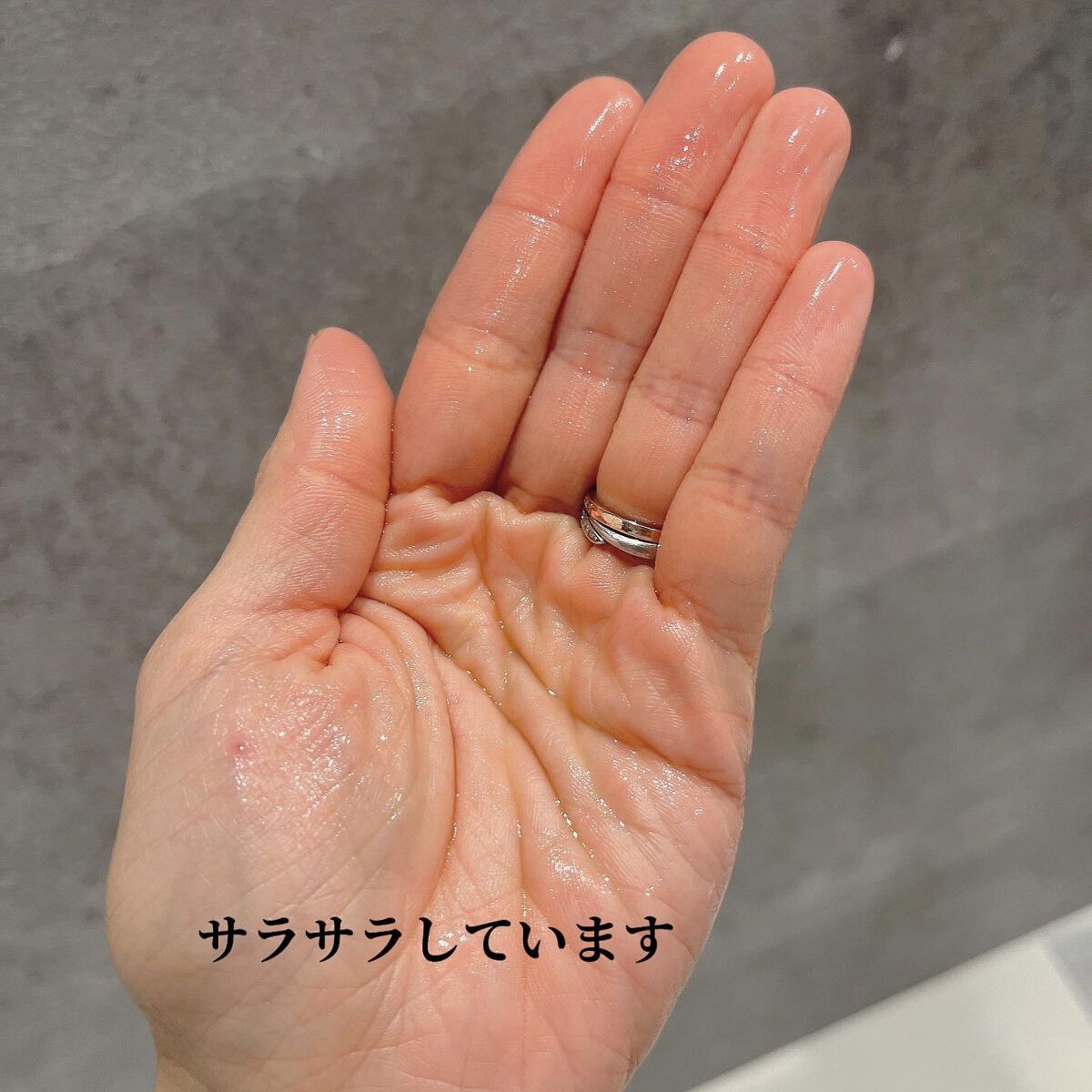 アクレオンセボエクストラクター/ANACIS/その他スキンケアを使ったクチコミ(3枚目)