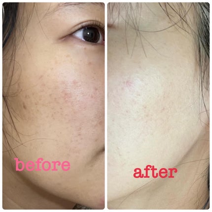 モデリングパック/Sunnicorn/シートマスク・パックを使ったクチコミ(4枚目)