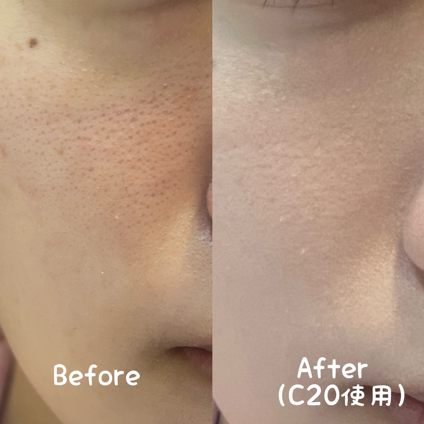 SPステイ ルミマット リキッド ファンデーション/MAYBELLINE NEW YORK/リキッドファンデーションを使ったクチコミ(4枚目)