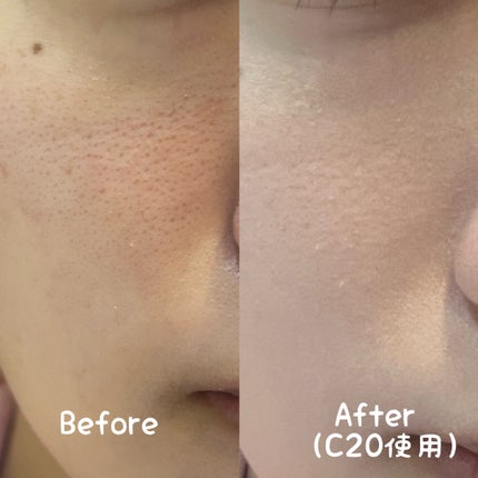 SPステイ ルミマット リキッド ファンデーション/MAYBELLINE NEW YORK/リキッドファンデーションを使ったクチコミ(4枚目)