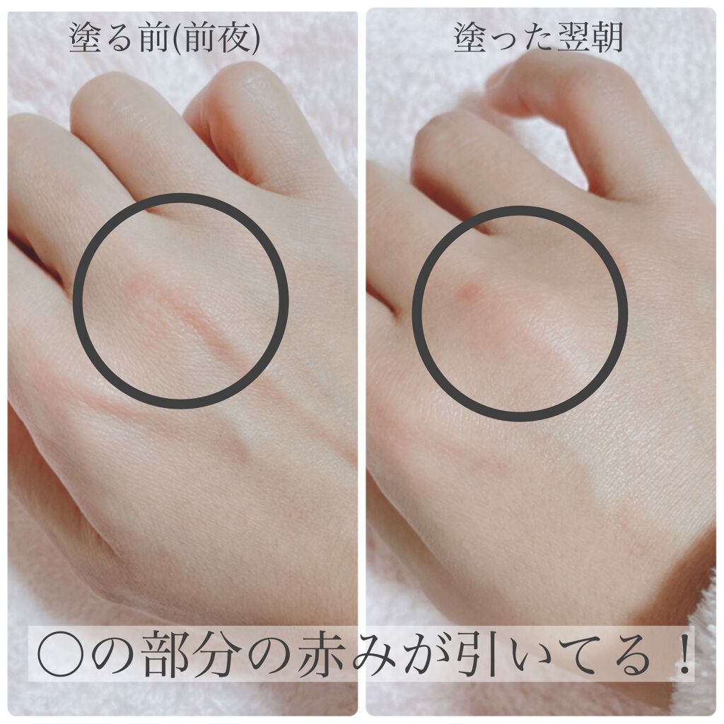 ERN on LIPS 「【速報】私の購入したドラッグストアモリ2月13日まで冬物セール..」(4枚目)