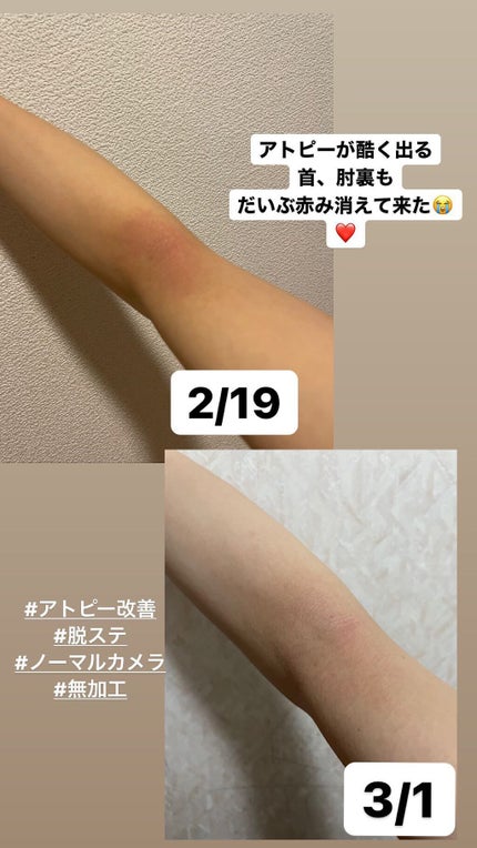 を使ったクチコミ(2枚目)