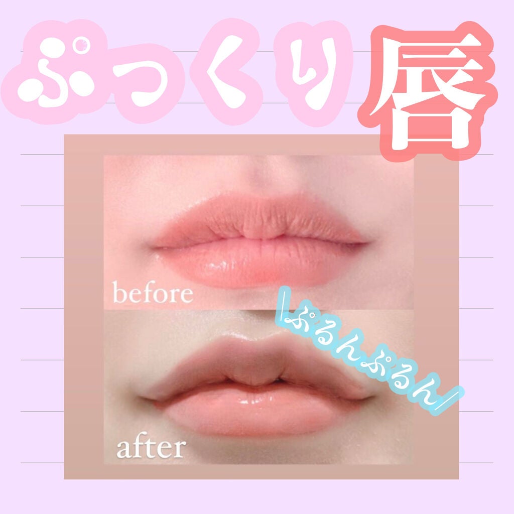 ゆんのこ on LIPS 「💋唇ケアについて💋□気になる唇の縦ジワ予防におすすめのアイテム..」(1枚目)