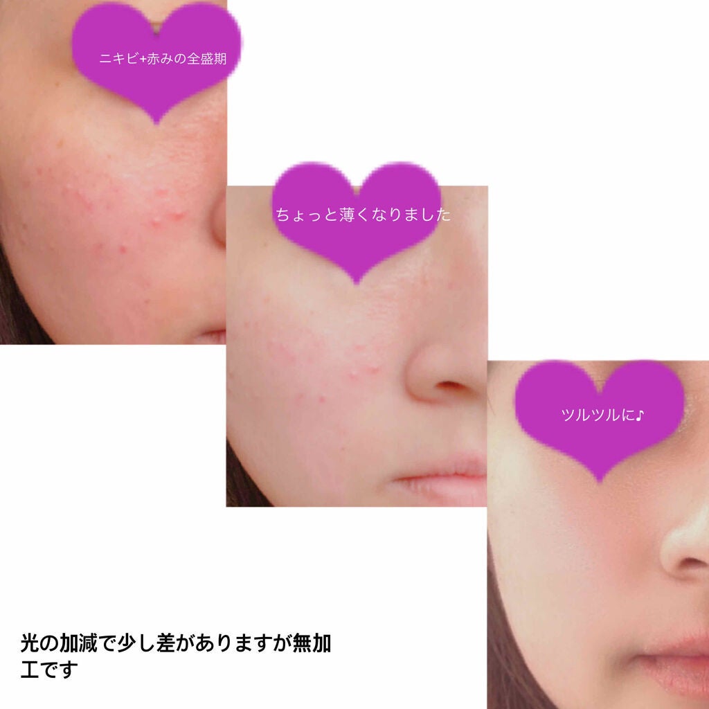 敏感肌用薬用美白美容液/無印良品/美容液を使ったクチコミ(3枚目)
