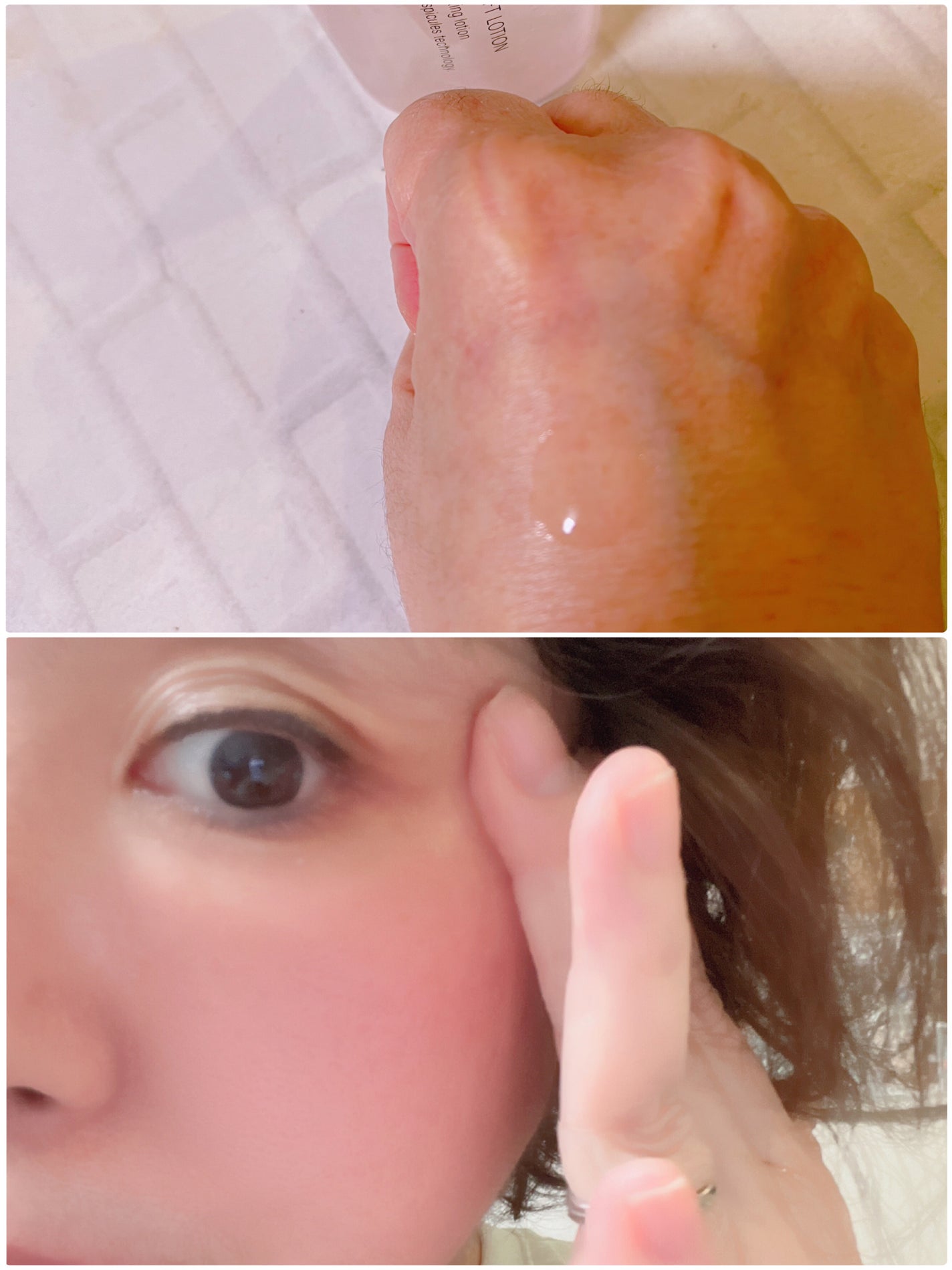 オタネ on LIPS 「メディリフトさんのメディリフトニードルリフトピールセラムとメデ..」(2枚目)