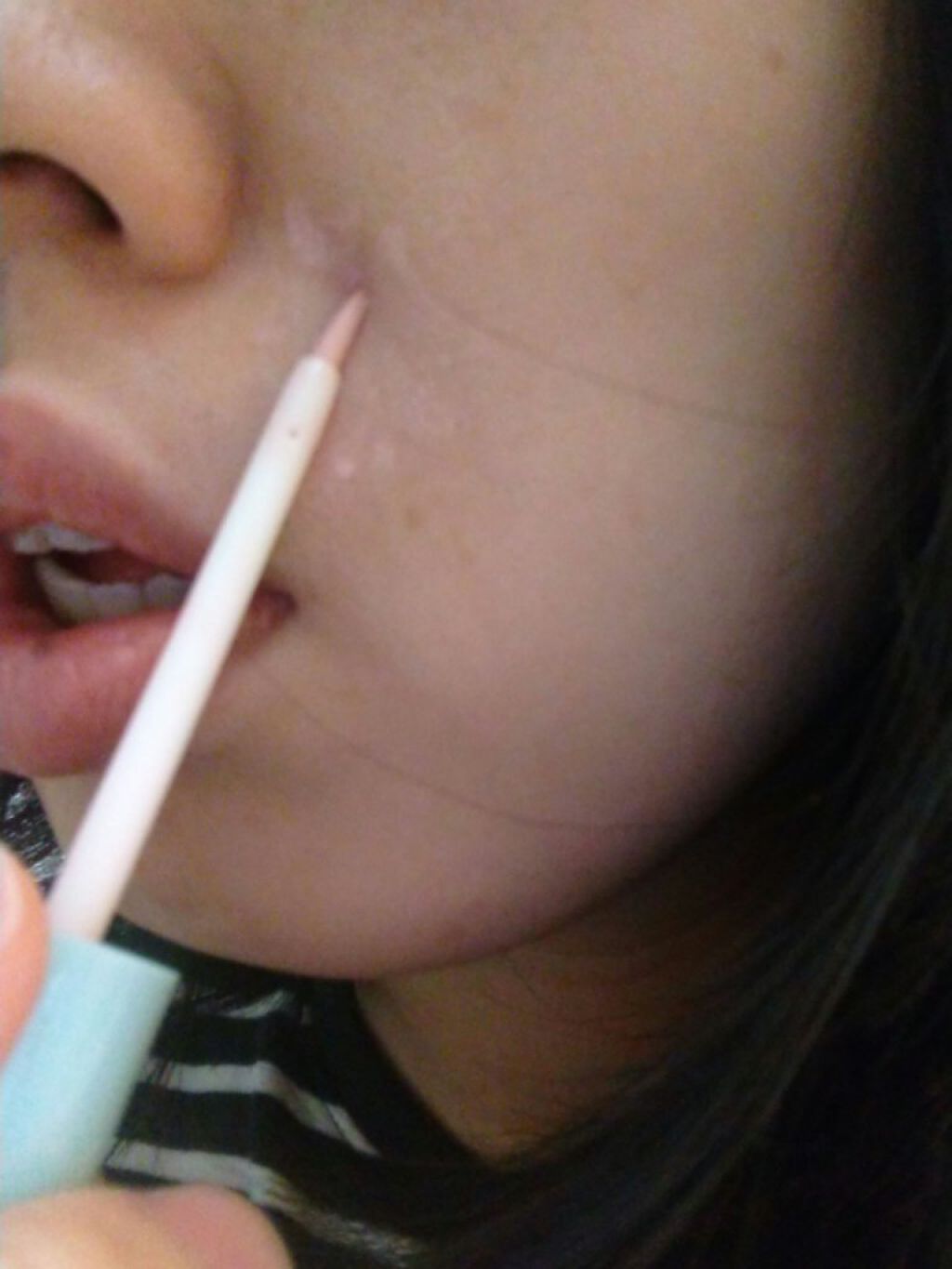 スポットパウダーエッセンス/ポツント/美容液を使ったクチコミ（2枚目）