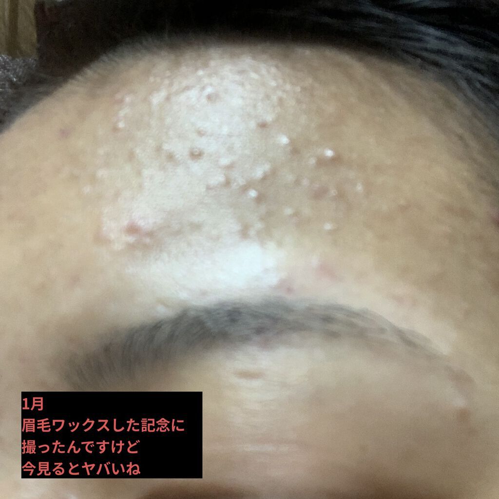 ハトムギ化粧水(ナチュリエ スキンコンディショナー R )/ナチュリエ/化粧水を使ったクチコミ（2枚目）