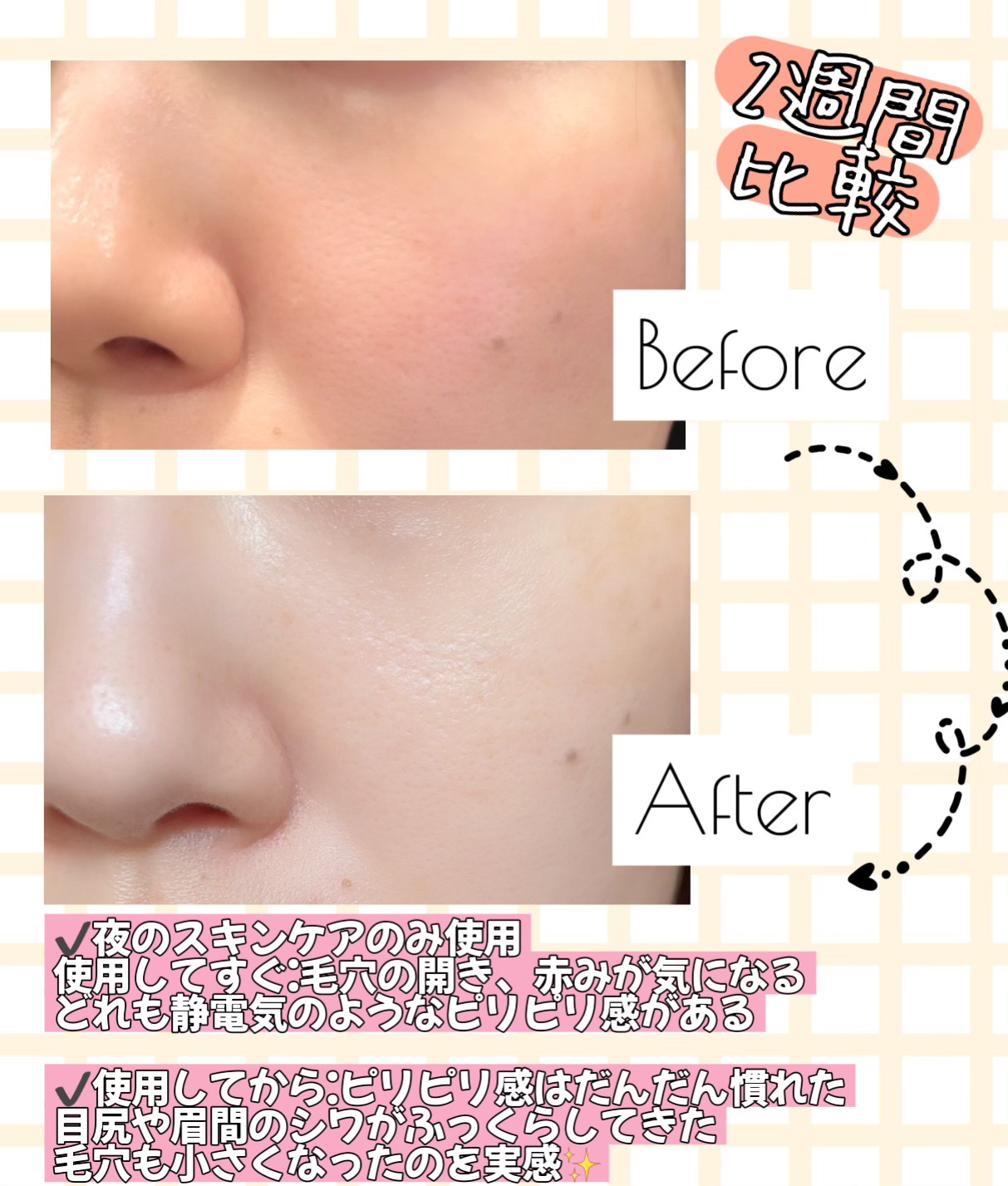リードルショット300/VT/美容液を使ったクチコミ（2枚目）