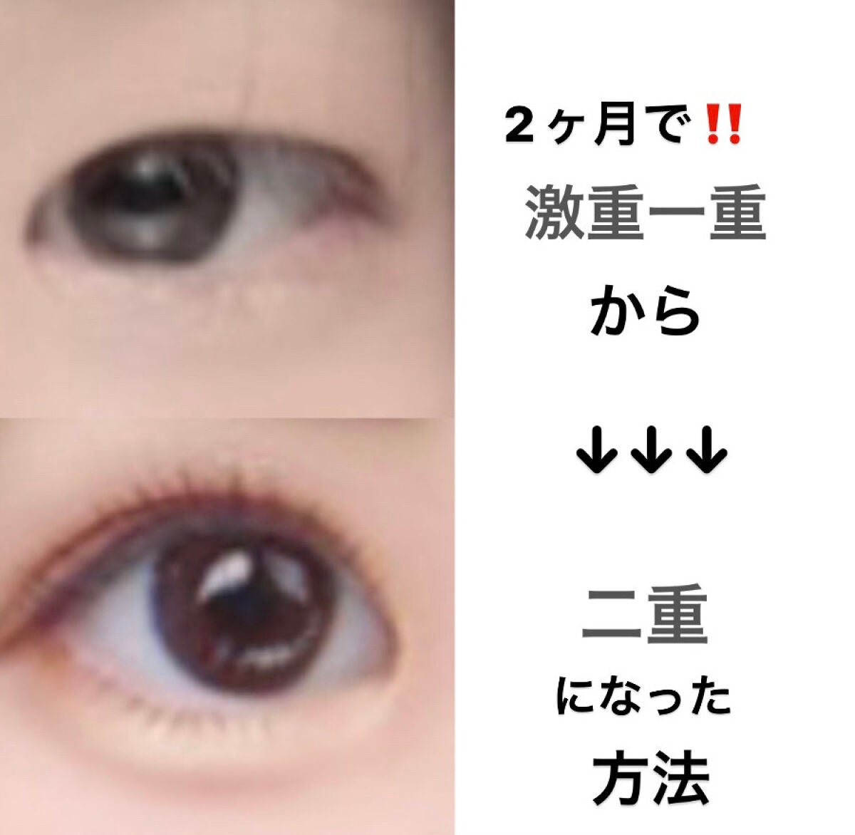 ワンダーアイリッドテープ Extra/D-UP/二重まぶた用アイテムを使ったクチコミ(1枚目)
