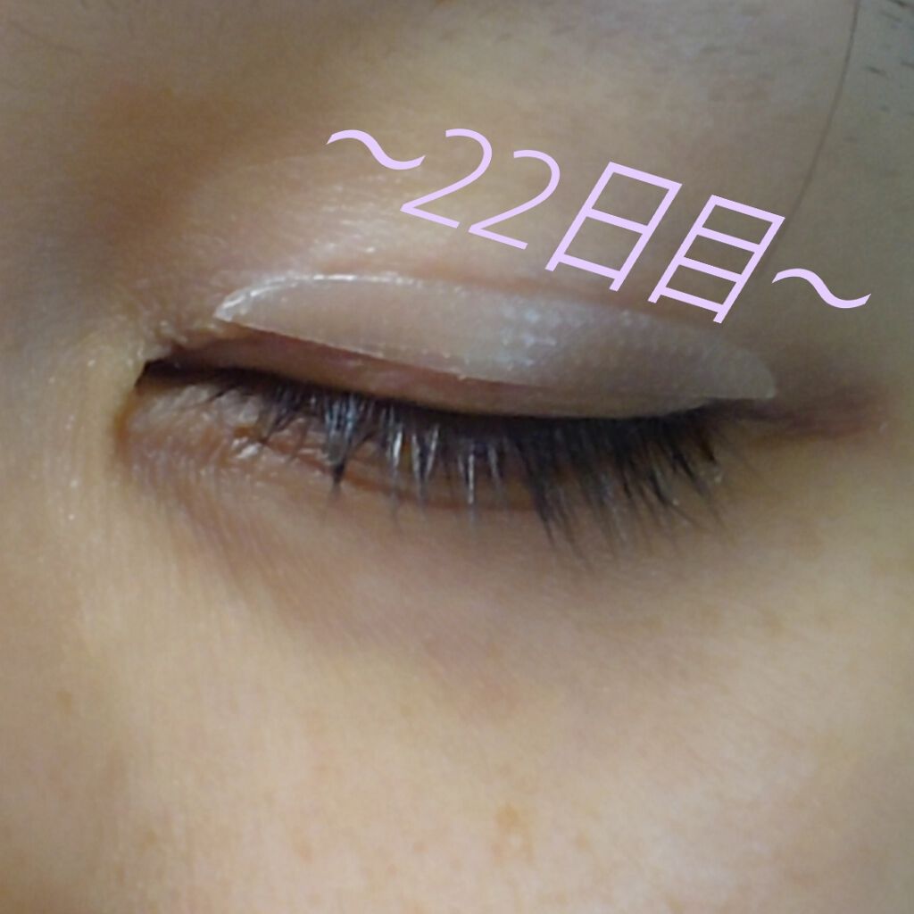 EMAKED（エマーキット）/水橋保寿堂製薬/まつげ美容液を使ったクチコミ（1枚目）