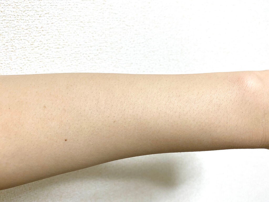 アイスレディ/icelady/家庭用脱毛器を使ったクチコミ(4枚目)