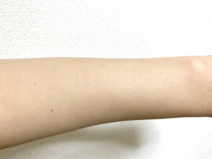 アイスレディ/icelady/家庭用脱毛器を使ったクチコミ(4枚目)