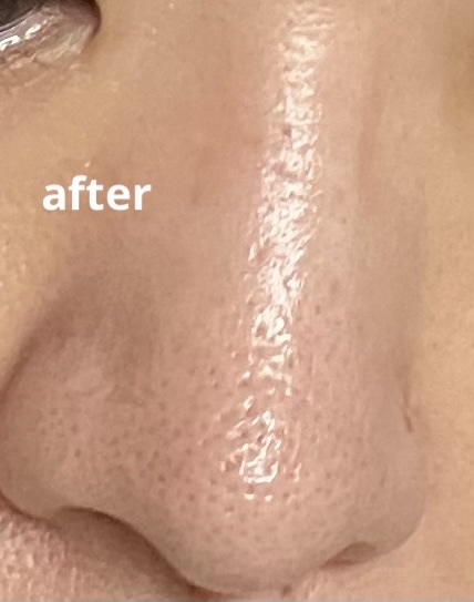 APPプラスローション GOプレミアム/ITO/ブースター・導入液を使ったクチコミ（3枚目）